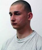 Policja poszukuje zbiegłego ze szpitala mężczyzny