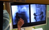 Nowatorskie zabiegi neurochirurgiczne w gorzowskim szpitalu