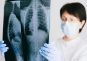 Nawet 3,5 tysiąca Polaków umiera z tego powodu